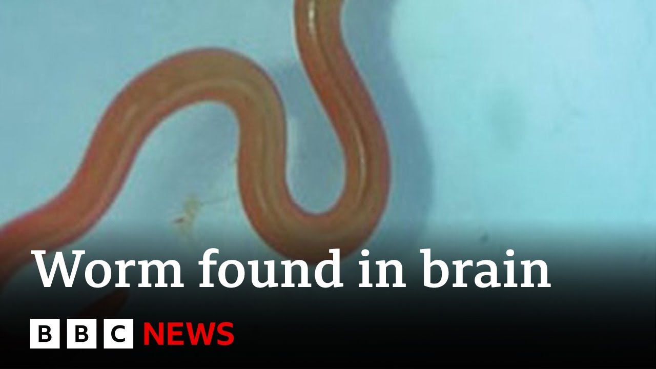 Live worm found in Australian woman's brain - BBC News