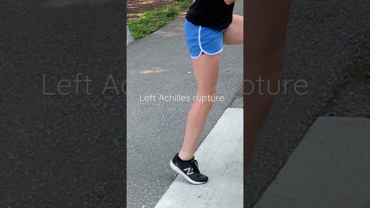 Achilles Tendon Rupture Caught on Camera